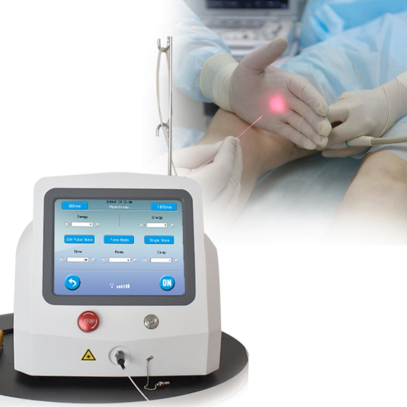 Varicose Veins Laser Treatment Machine 980nm Diode Laser 1470nm Removal Varicose Vein Device