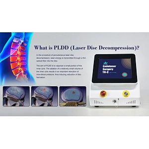2024 the Hottest Machine PLDD Laser Treatment Diode Laser 980nm 1470nm for PLDD