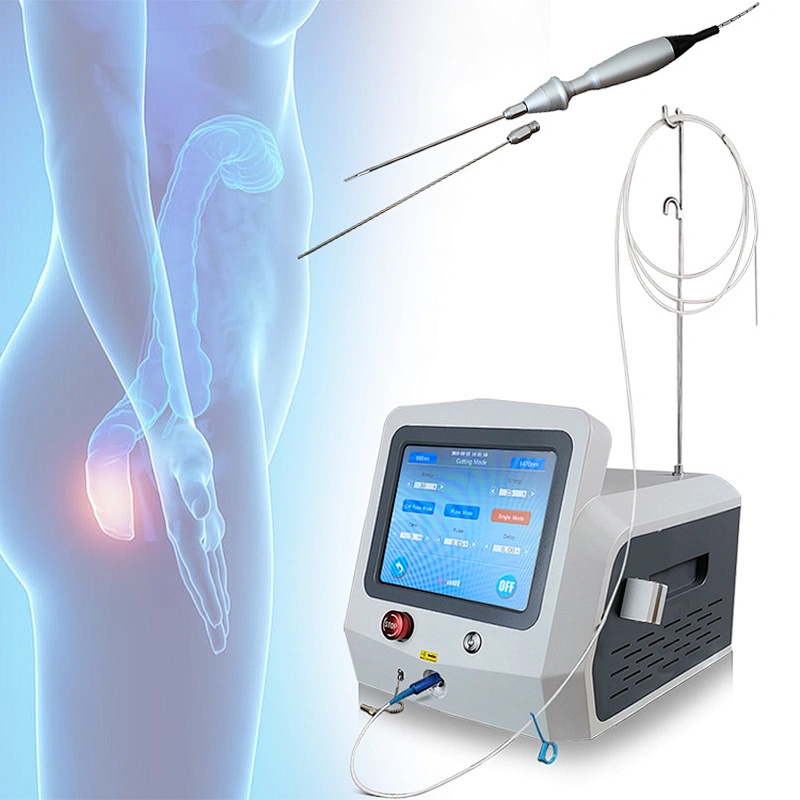 German Tech Medical 1470nm Laser Cutting Hemorrhoids Medicine Piles Hemorroid Treatment Proctology Laser