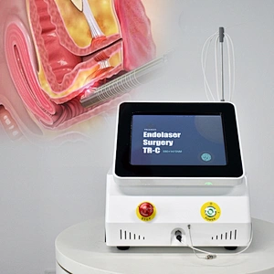 Gynecological Vaginal Laser Therapy  Instruments 980nm 1470nm Medical Laser  Tighten Vaginal and Rejuvenation Surgery Equipment