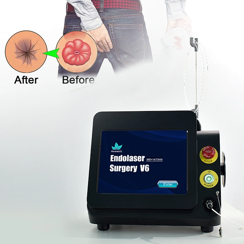 Hot Sale 980nm 1470nm Diode Laser Treatment Hemorrhoid Laser Ablation Proctology Surgical Laser Machine