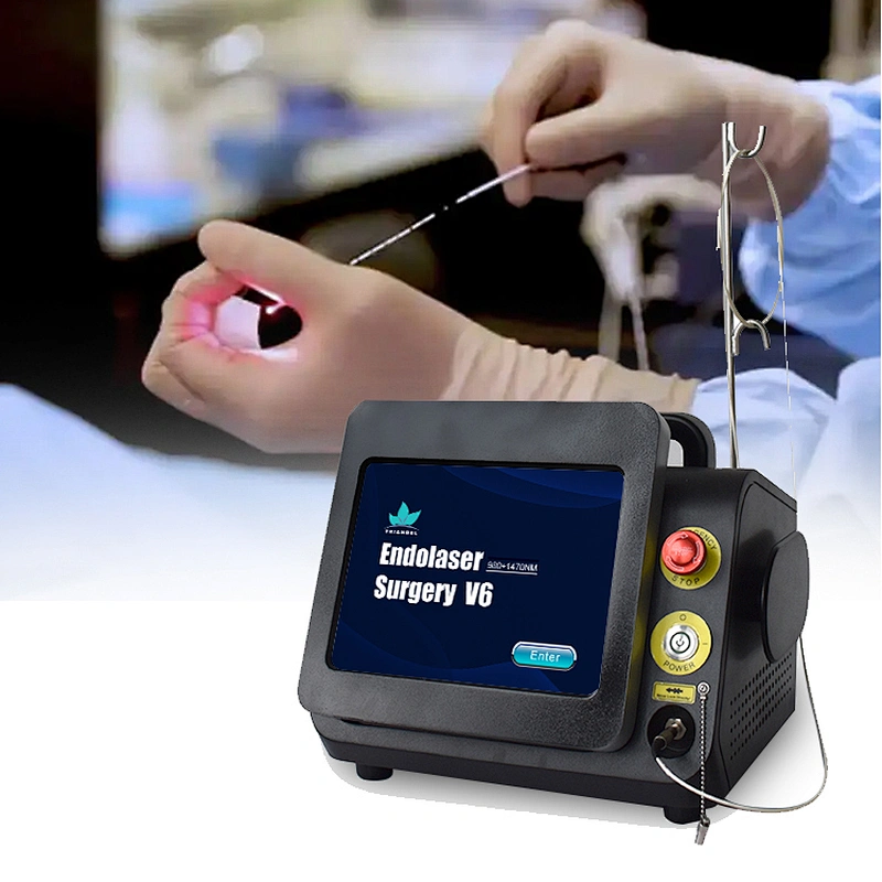 Factory Supply Best Quality EVLT Laser Varicose Veins Removal High Power Varicosity Treatment for Sale