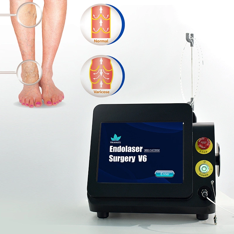 High quality radial fiber varicose veins 980nm diode laser 30w mini-invisive laser machine for evlt fibra radial