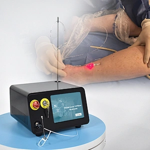 Diode Laser Ablation EVLT EVLA1470nm Endovenous Laser Treatment Legs Varicose Vein Surgical Device