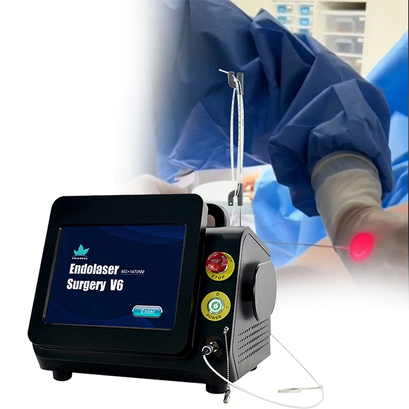 Laser Evlt Vascular Surgeon 1470nm EVLT Treatment EVLA Laser Legs Care Varicose
