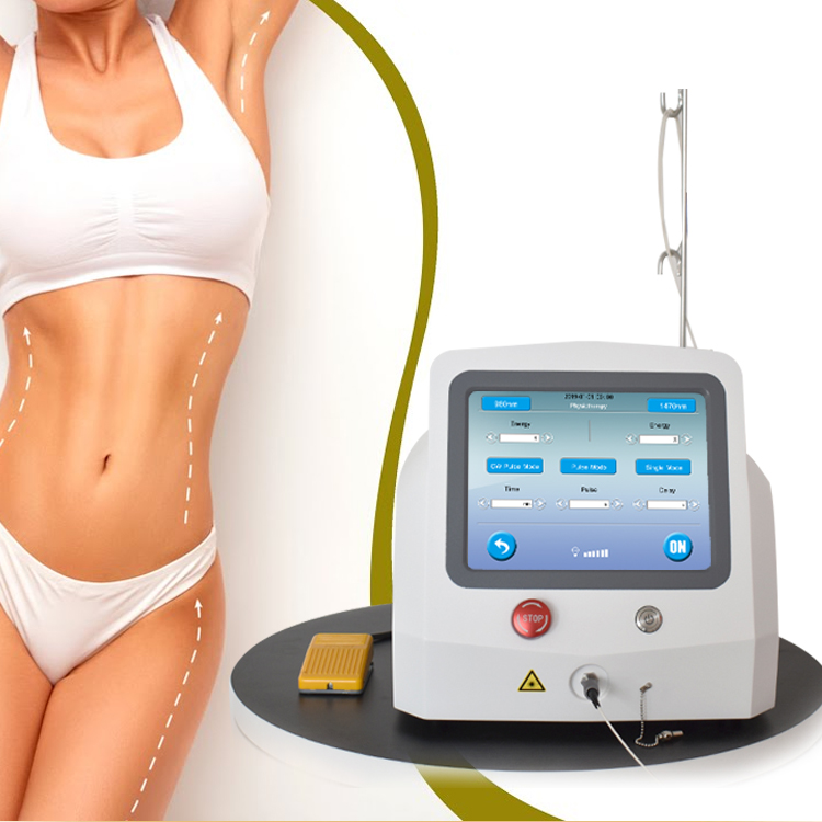 Lipolysis Laser