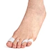 toe separators for overlapping toes