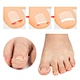 Nail correction patch set - complete kit with different sizes for all nail problems