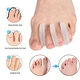 spacer for bunion