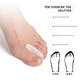 spacer for bunion
