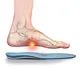 Running shoe arch support inserts with orthopedic design for overpronation control