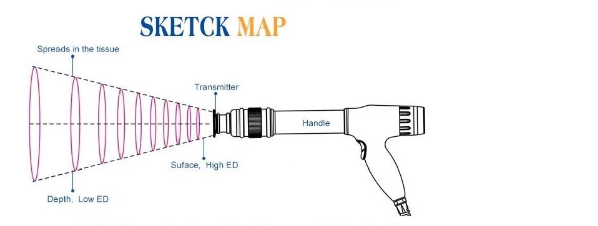 shockwave therapy machine