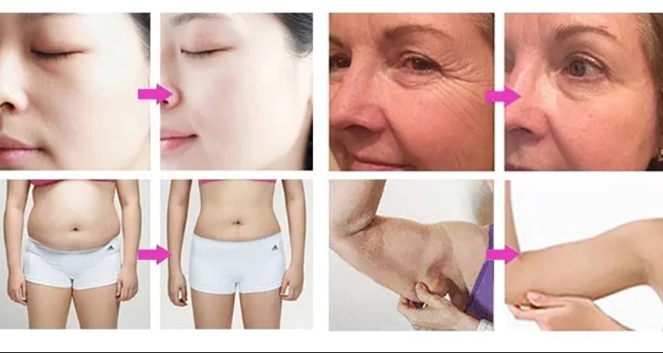 5 in 1 Cavitation machine
