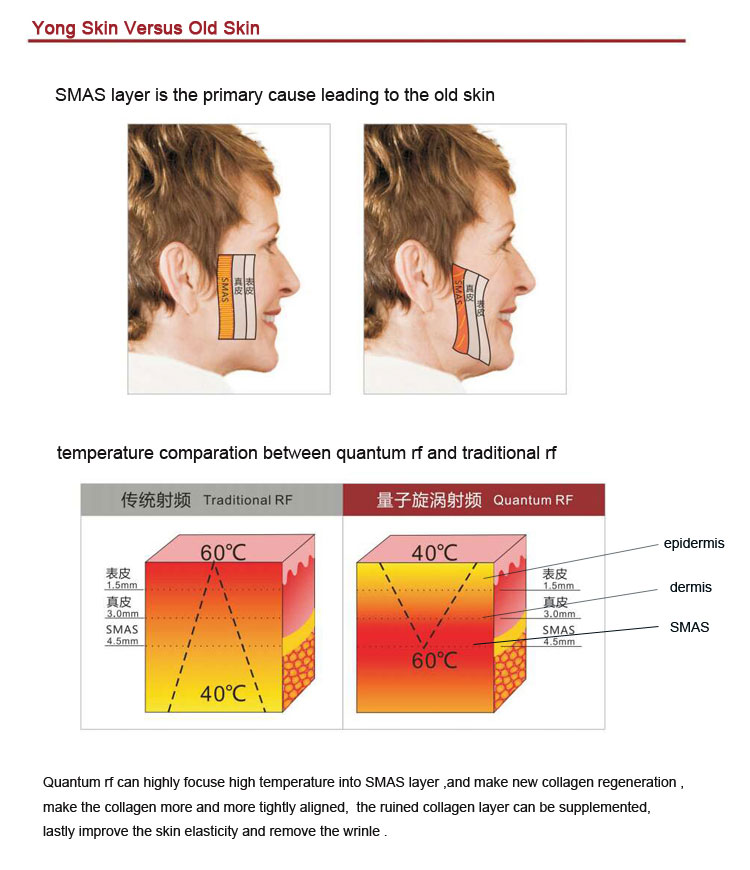 Quantum RF face lifting RF machine