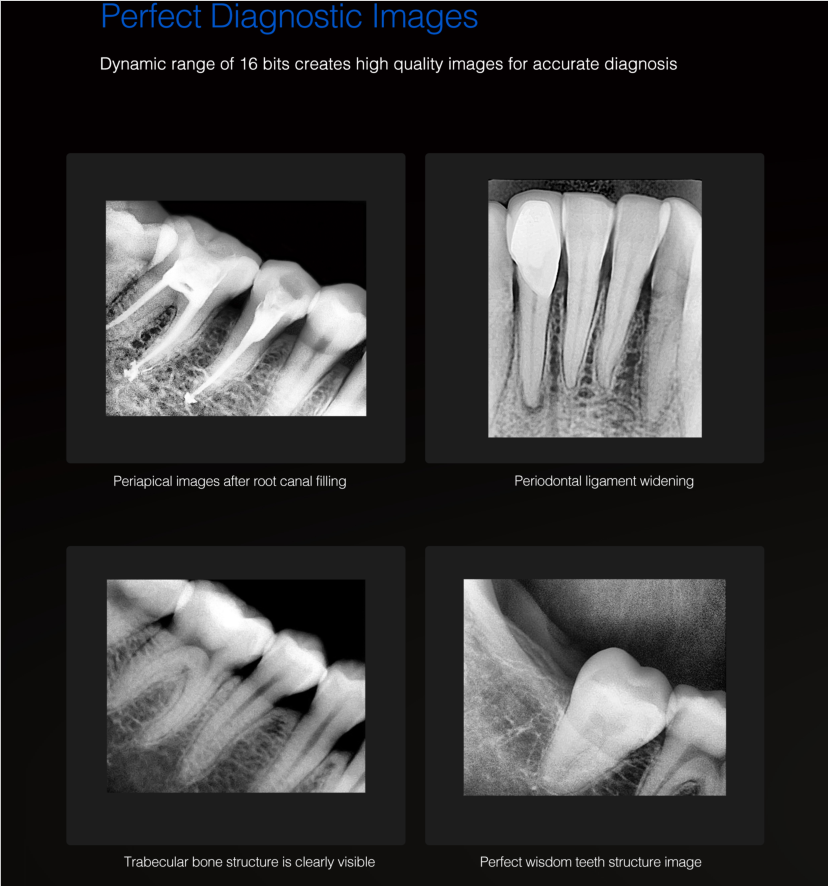Dental sensor