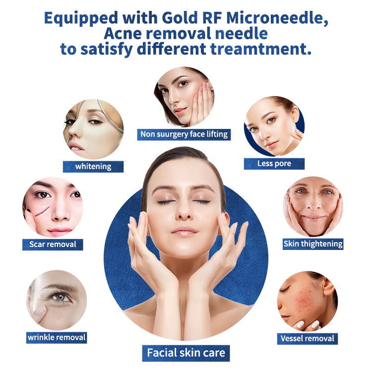 RF microneedling machine