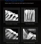 Dental sensor