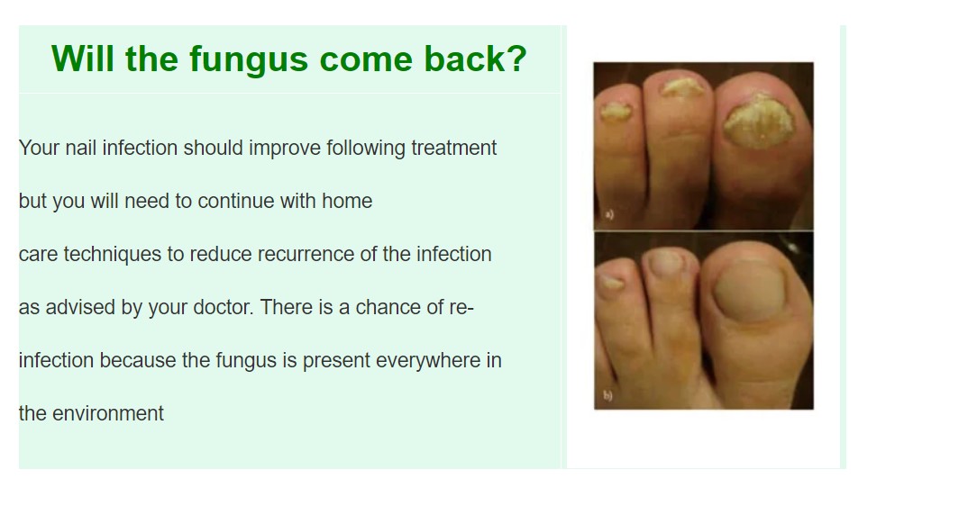 Toenail Fungus nail laser treatment device
