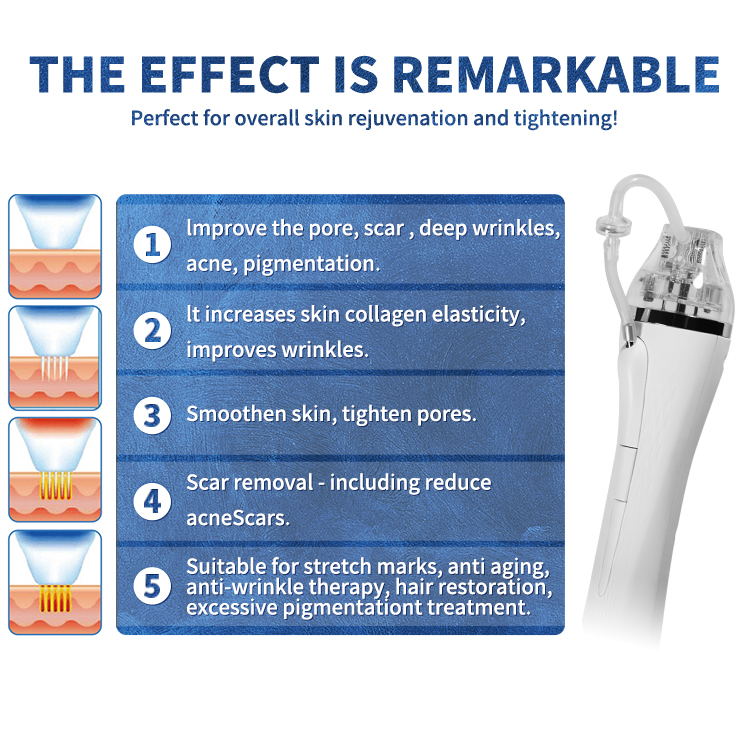 RF microneedling machine