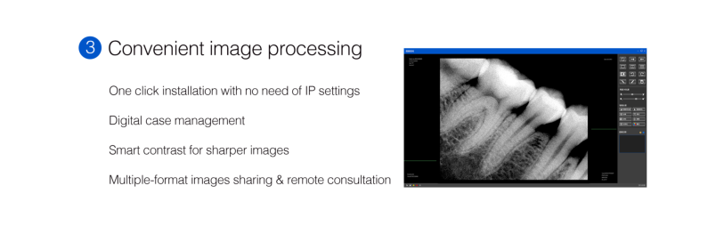 Dental sensor