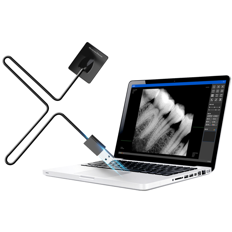Dental sensor