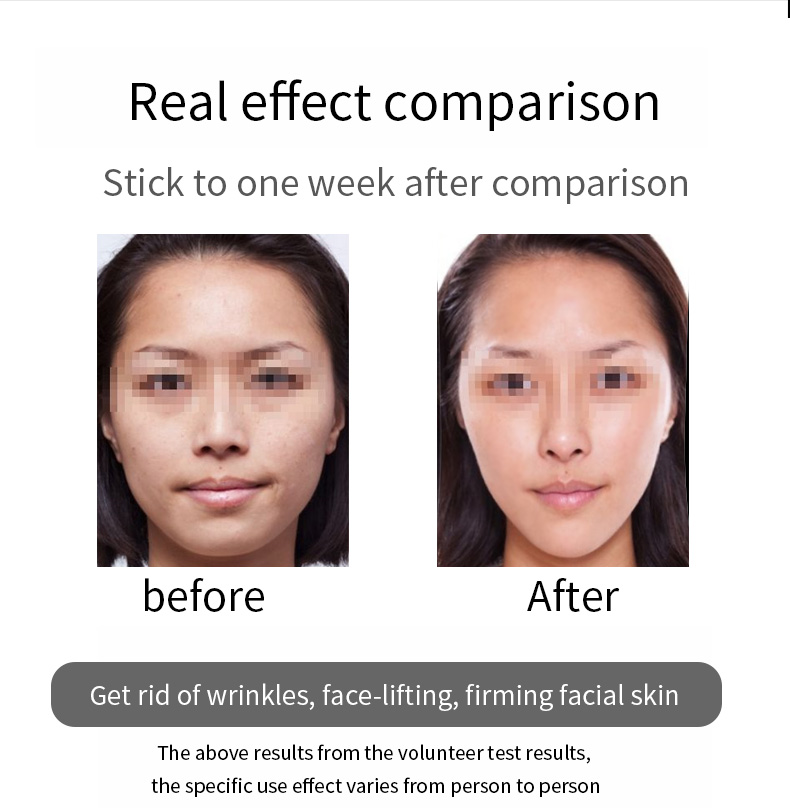 Facial Neck Body Massager Beauty Device
