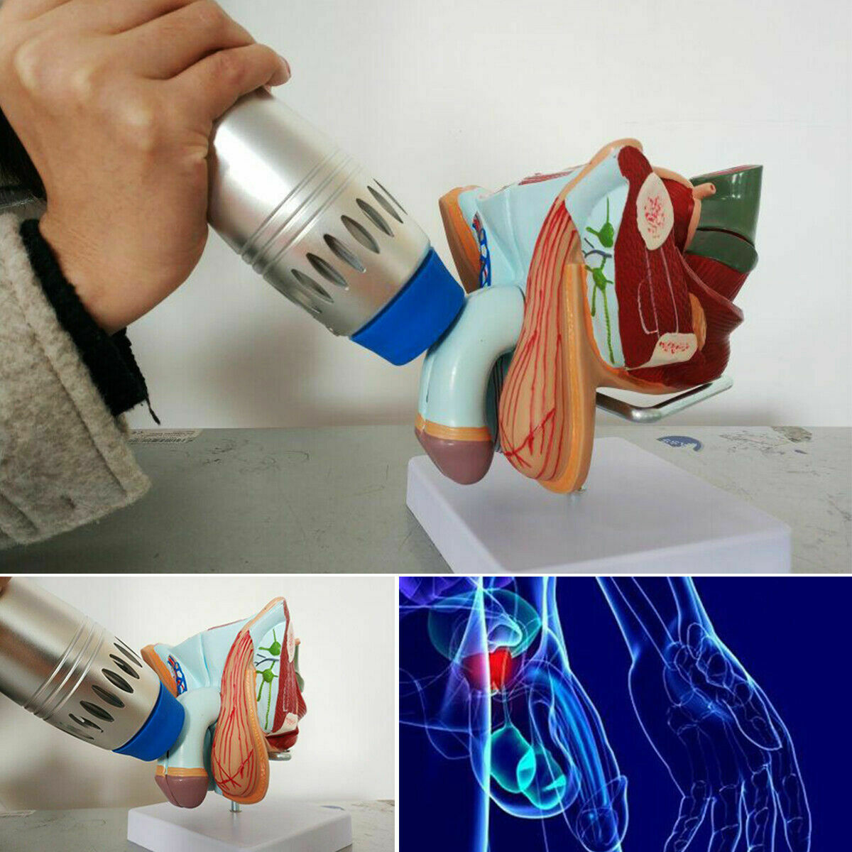 hot sell therapy machine shockwave for erectile dysfunction/ed