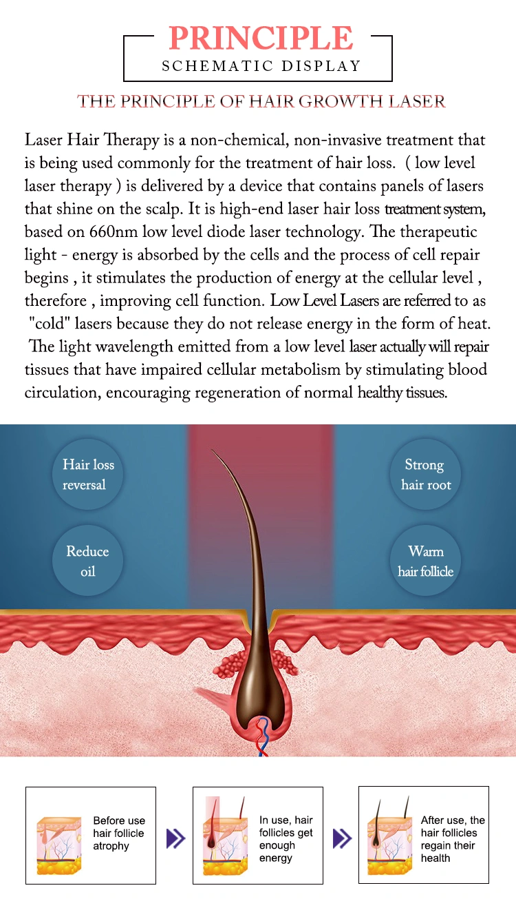 Hair loss treatment 660nm laser hair regrowth equipment HR68