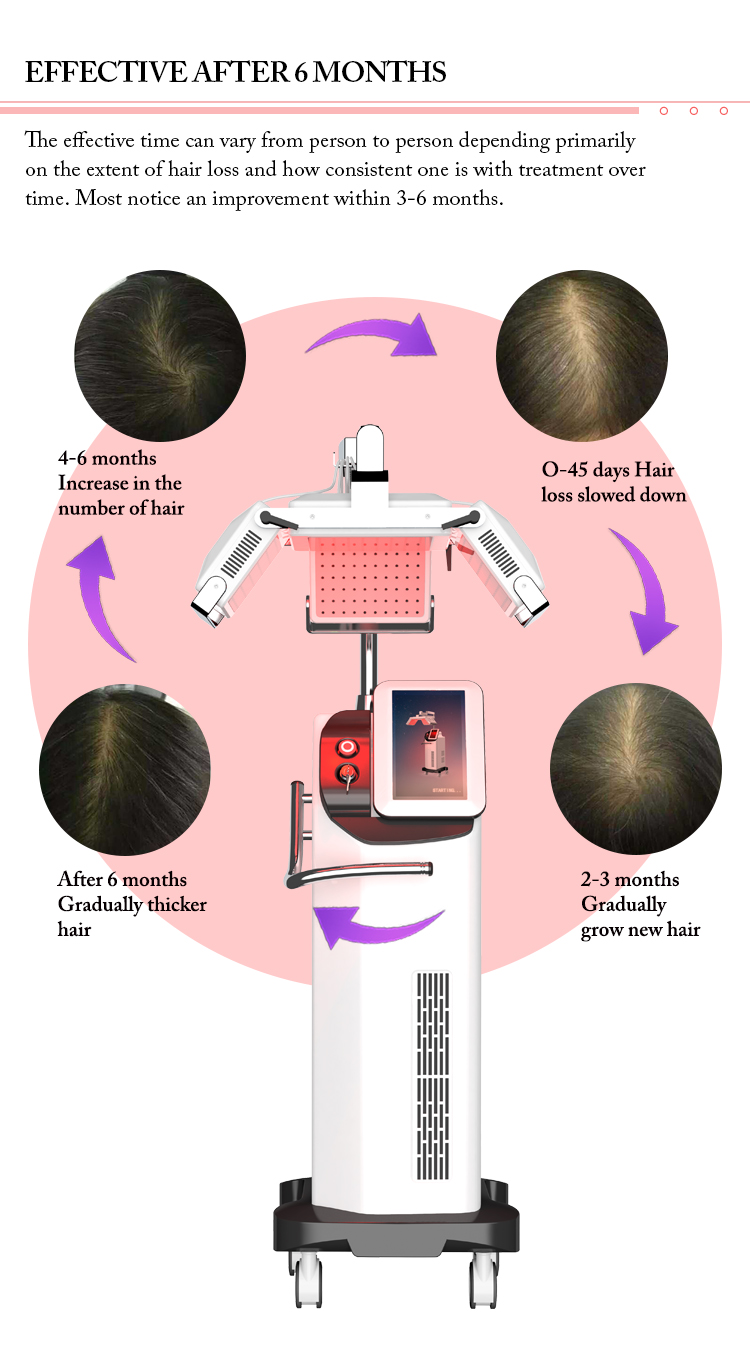 Hair loss treatment 660nm laser hair regrowth equipment HR68