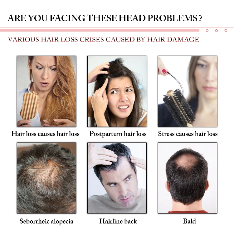 Hair loss treatment 660nm laser hair regrowth equipment HR68