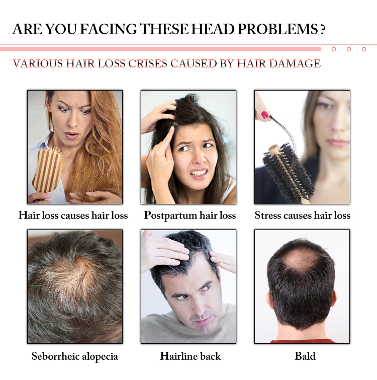 Hair loss treatment 660nm laser hair regrowth equipment HR68