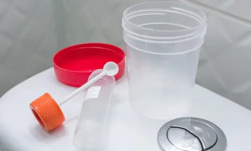 stool sample container
