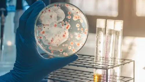 bacteria culture plates