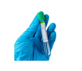 Blood Sample Collection Tubes