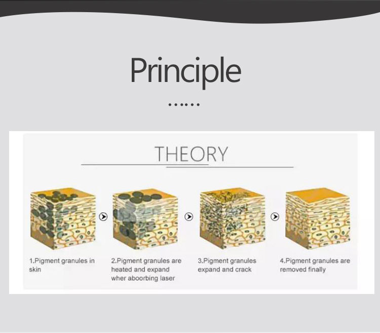 Q Switched Nd Yag Laser Tattoo Removal Machine