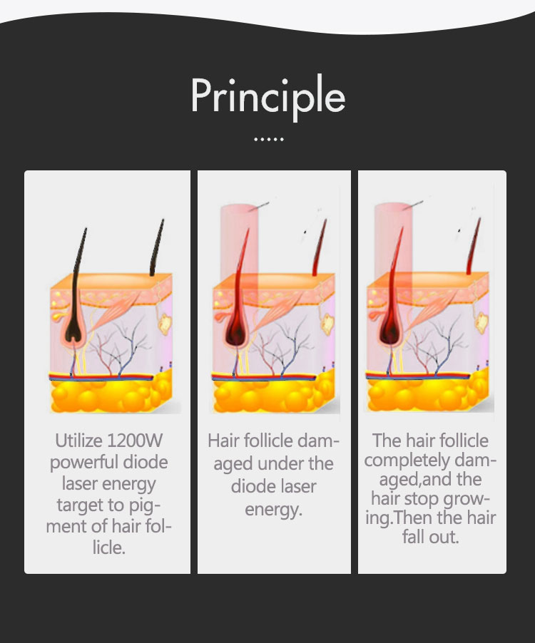 Diode Laser Hair Removal Machine