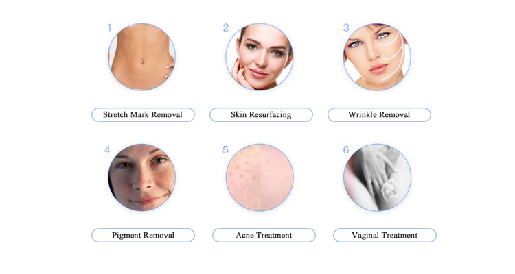 Fractional Co2 laser