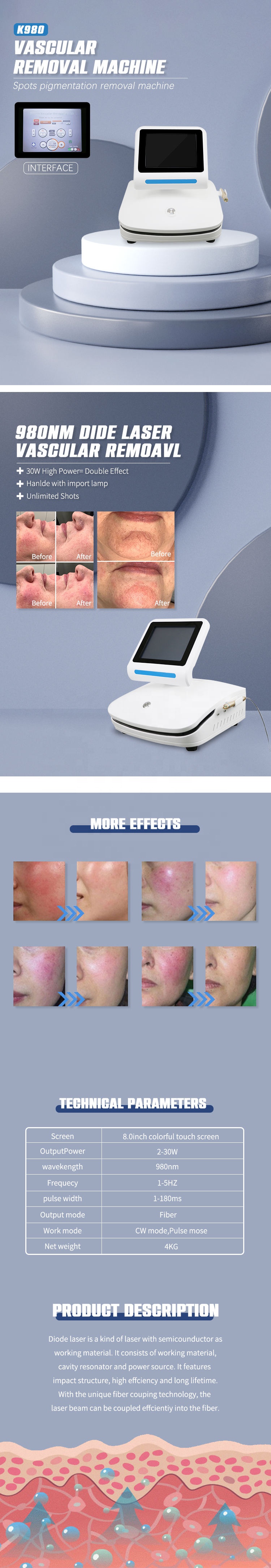 Blood Vessels Removal