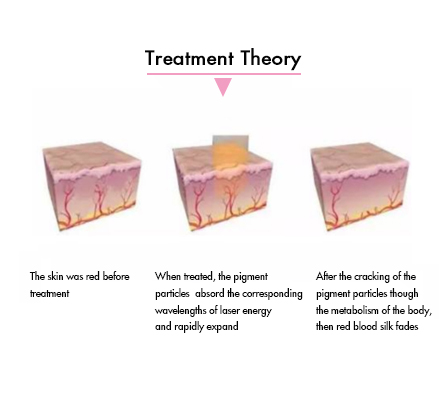 Blood Vessels Removal