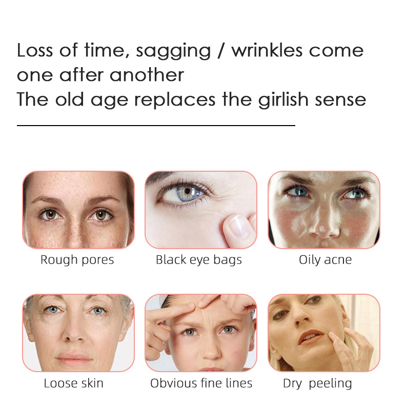 Radio frequency skin tightening machine