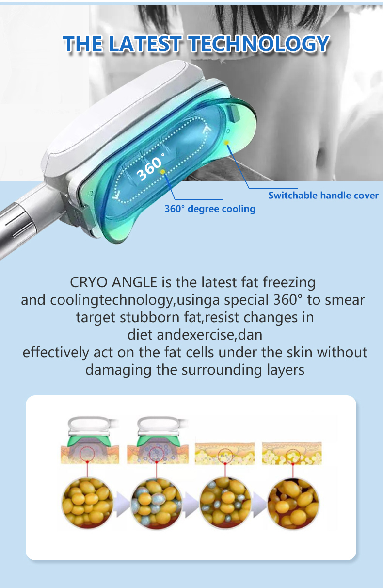cryo ems