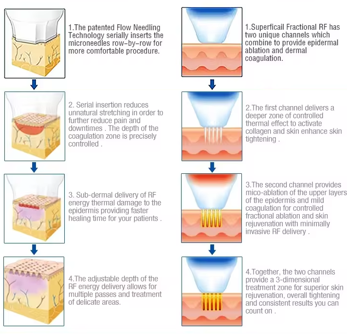 RF Microneedle Ice hammer machine