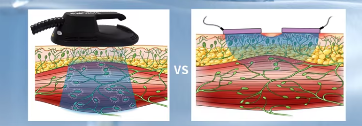 ems sculpting machine