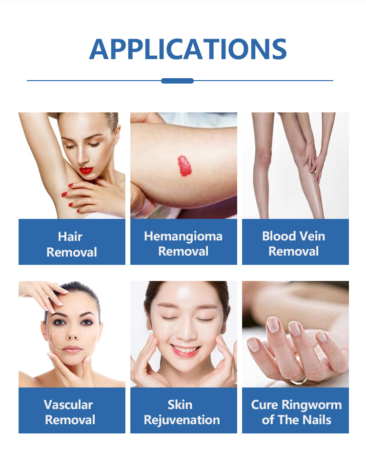 755nm laser alex hair removal