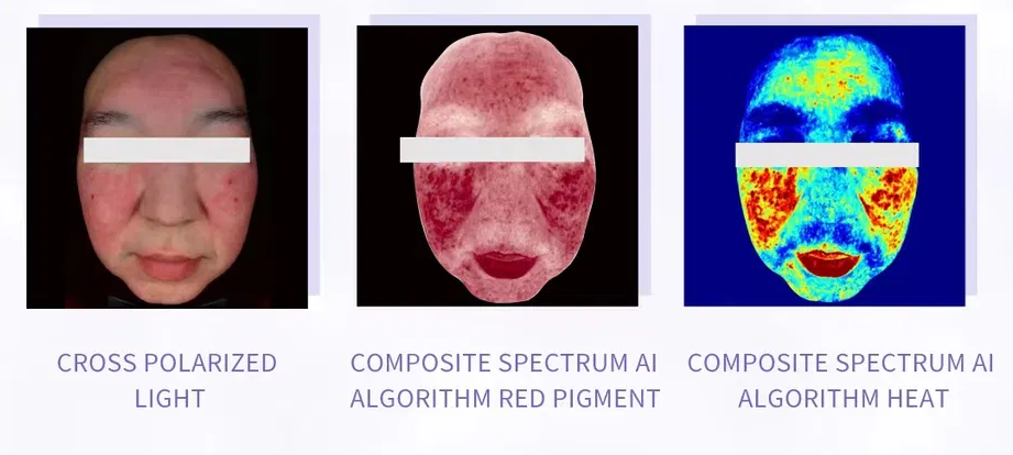 skin analyzer machine