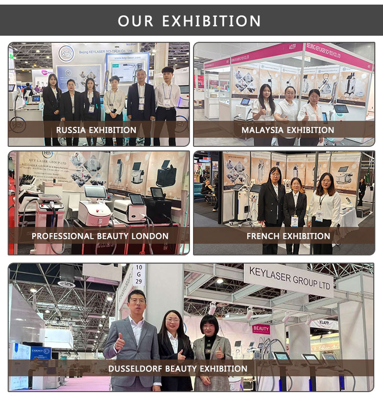 Q Switched Nd Yag Laser Tattoo Removal Machine