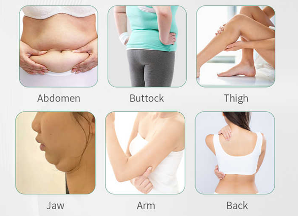 Cryolipolysis slimming machine