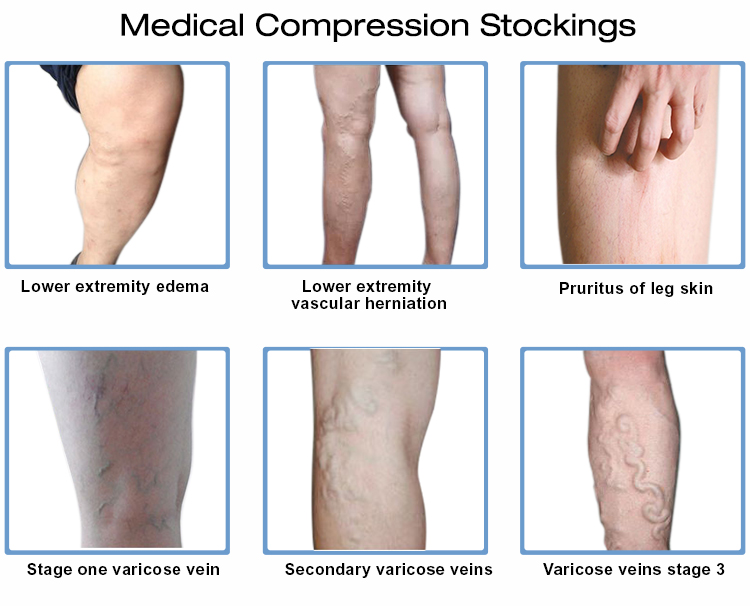 Thin Compression Socks for Summer