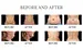 cavitation machine 80k