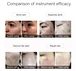 Plasma Skin Tightening machine